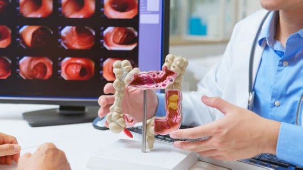 الحقيقة الصادمة عن أدوية القولون العصبي #صحة 