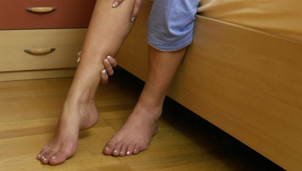 من أعراض اعتلال الأعصاب السكري خدر ووخز في الأطراف العلوية والسفلية